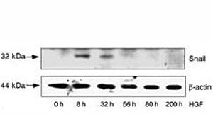 SNAIL Antibody (SNAI1)