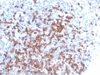 IHC staining of FFPE human tonsil tissue with CD8A antibody. HIER: boil tissue sections in pH 9 10mM