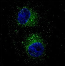 Fluorescent confocal image of HepG2 cells stained with MET antibody. Note the highly specific locali