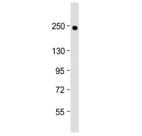 Western blot testing of human lung lysate with COL14A1 antibody at 1:2000. Predicted molecular weigh
