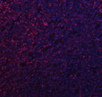 MFF Antibody / Mitochondrial fission factor