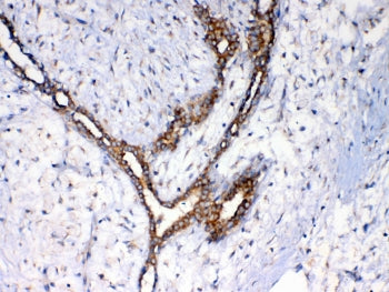 NSF Antibody / Vesicle-fusing ATPase