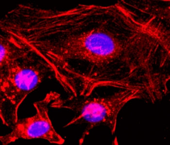 Beta Actin Antibody