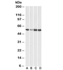 Western blot testing of human [A], fetal mouse [B], adult mouse [C] and adult rat [D] heart lysates with ATP5A1 antibody at 0.01ug/ml. Predicted molecular weight ~54-60 kDa (multiple isoforms).