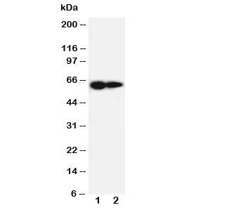 IL-2 Receptor Antibody (beta subunit)