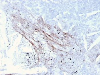 Tenascin C Antibody