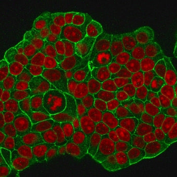 Immunofluorescent staining of MeOH-fixed human MCF7 cells with HER-2 antibody (clone ERB2/776, green
