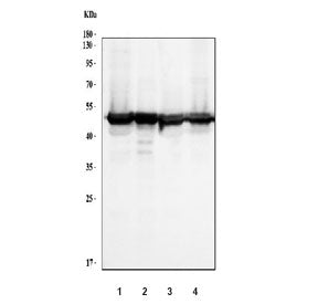 Western blot testing of human 1) 293T, 2) A431, 3) HepG2 and 4) Raji cell lysate with Regulator of C