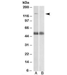 Western blot testing of human prostate lysate with COPA antibody at 0.5ug/ml with [B] and without [A