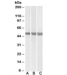 Western blot testing of Daudi [A], Jurkat [B] and HepG2 [C] lysates with DDX6 antibody at 0.3ug/ml. 