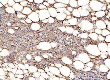 NDUFB8 Antibody
