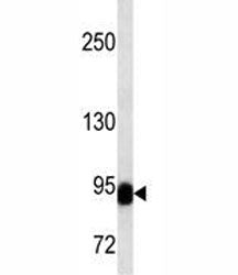 BCL6 Antibody