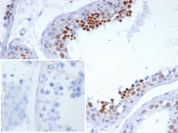 IHC staining of FFPE human testis tissue with NUTM1 antibody (clone SNUPN/7351R). Inset: PBS used in