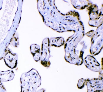 IHC staining of FFPE human placental tissue with AFF4 antibody. HIER: boil tissue sections in pH8 ED