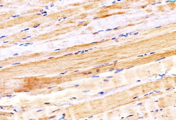 MYH6 Antibody / Myosin 6