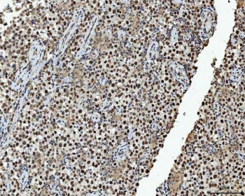hnRNP L Antibody / HNRPL / HNRNPL