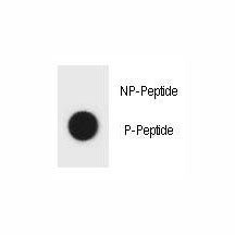 Dot blot analysis of phospho-TSC1 antibody. 50ng of phos-peptide or nonphos-peptide per dot were spo