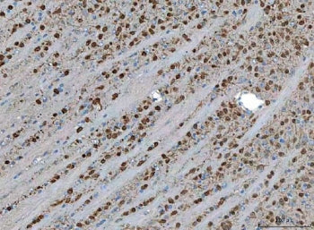 TSR2 Antibody