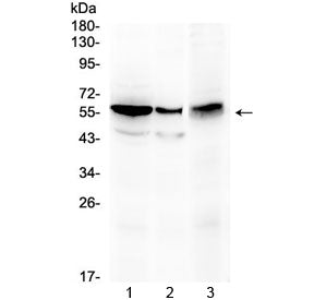 Western blot testing of 1) rat kidney, 2) mouse stomach and 3) human HepG2 lysate with ALDH1A3 antib