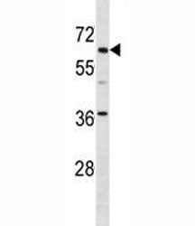 TFE3 Antibody