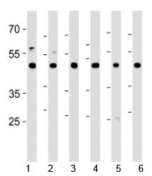 CTBP1 antibody western blot analysis in 1) HeLa, 2) HL-60, 3) Jurkat, 4) Raji cell lines, 5) mouse b