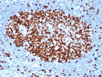 IHC staining of FFPE human tonsil tissue with recombinant Ki67 antibody (clone rMKI67/6499). HIER: b