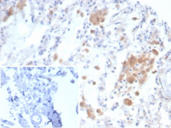 CD91 Antibody / LRP1 / A2MR