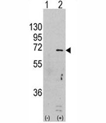 Western blot analysis of AMPK antibody and 293 cell lysate (2 ug/lane) either nontransfected (Lane 1
