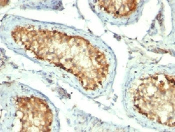 HSP60 Antibody
