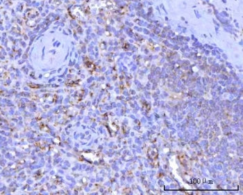 IHC staining of FFPE human spleen tissue with ITGA2B antibody. HIER: boil tissue sections in pH8 EDT