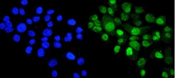 Immunofluorescent staining of FFPE human A431 cells with Cyclophilin E antibody (green) and DAPI nuc