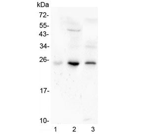 Grancalcin Antibody / GCA
