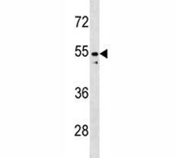 PAX2 antibody western blot analysis in K562 lysate