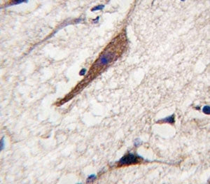 PAK5 Antibody