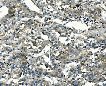 AKR1D1 Antibody