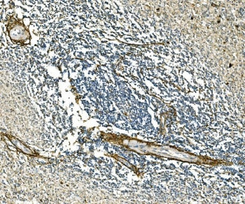 IHC staining of FFPE human spleen tissue with COL1A1 antibody. HIER: boil tissue sections in pH8 EDT