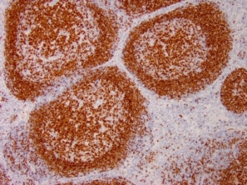 IHC testing of human tonsil with PAX5 antibody. Required HIER: boil tissue sections in pH 9 10mM Tri