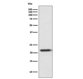 TIMP2 Antibody