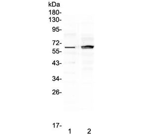 Frizzled 4 Antibody / FZD4