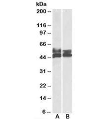 Western blot testing of human tonsil [A] and thymus [B] lysates with FCRL1 antibody at 0.5ug/ml. Pre