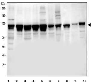 Western blot testing of 1) human HeLa, 2) human K562, 3) human MCF7, 4) human COLO-320, 5) human Hep