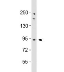 Western blot testing of human Jurkat cell lysate with NUP93 antibody at 1:1000. Predicted molecular 