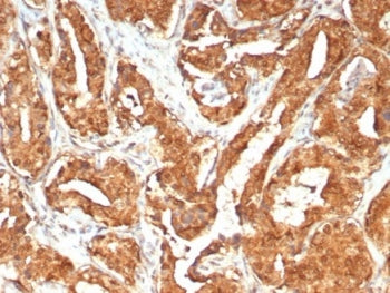 MIF Antibody / Macrophage migration inhibitory factor