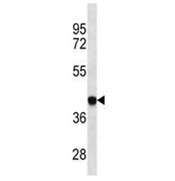 HLA-B Antibody