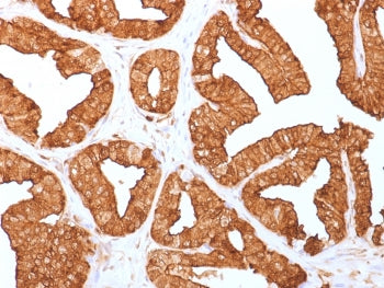 IHC staining of FFPE human prostate with Annexin A1 antibody (clone ANXA1/1671). HIER: boil tissue s