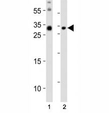 Western blot analysis of lysate from (1) mouse brain and (2) mouse skeletal muscle tissue lysate usi