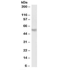 Western blot testing of human cerebellum lysate with PPP2R5B antibody at 2ug/ml. Predicted molecular