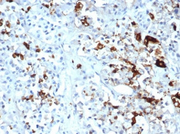 Prolactin Antibody / PRL
