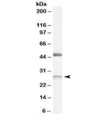 BNIP1 Antibody
