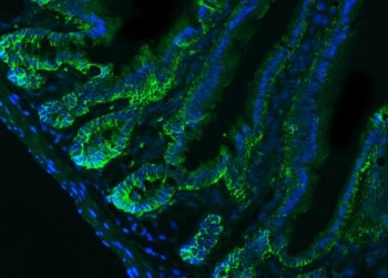 Epcam Antibody